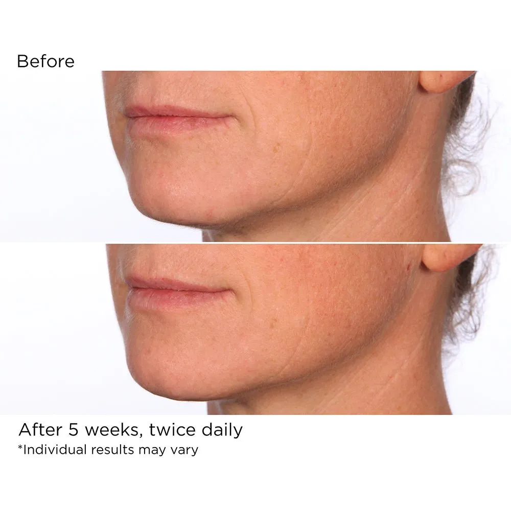 Hydro-Screen Serum